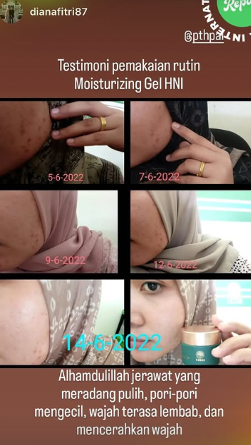 Testimoni Diana Fitri tentang HNI MOISTURIZING GEL